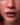Close-up of a person's lips with 'Ridmii' branding.