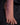 Close-up of a foot with 'Ridmi' branding on a dark background