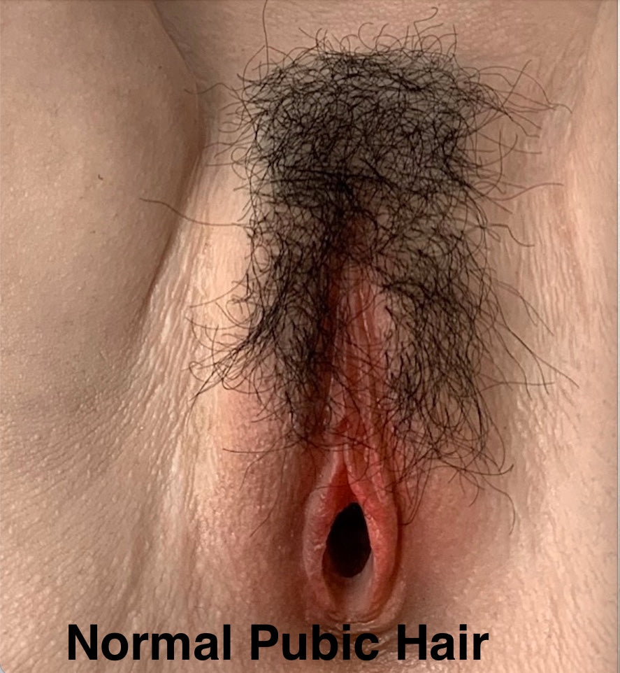 Normal Pubic Hair